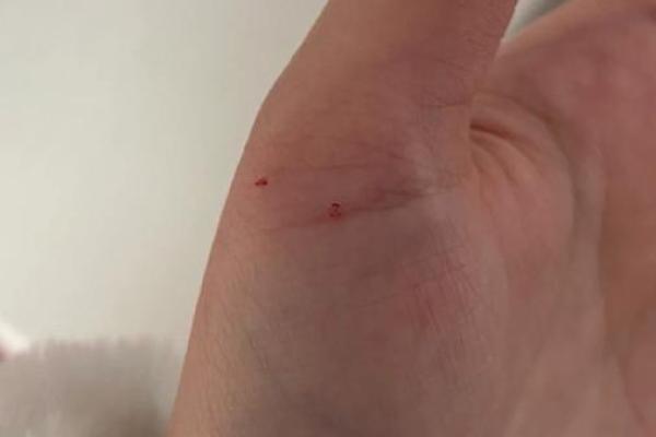 梦见被猫咬手 梦见被猫咬手